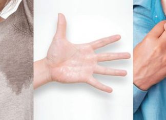 Гипергидроз: причины появления, при каких заболеваниях возникает, диагностика и способы лечения Гипергидроз: причины появления, при каких заболеваниях возникает, диагностика и способы лечения.